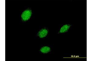 Immunofluorescence of monoclonal antibody to LHX5 on HeLa cell. (LHX5 Antikörper  (AA 136-235))