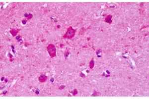 Anti-GRM8 / MGLUR8 antibody IHC staining of human brain, cortex. (GRM8 Antikörper  (N-Term))