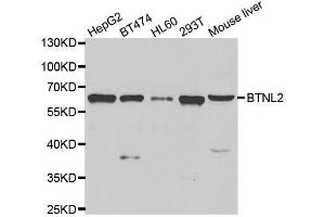 Western blot analysis of extracts of various cell lines, using BTNL2 antibody. (BTNL2 Antikörper  (AA 246-455))