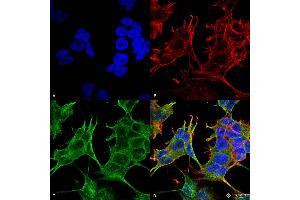 Immunocytochemistry/Immunofluorescence analysis using Mouse Anti-GluN2A/NR2A Monoclonal Antibody, Clone S327-95 . (NMDAR2A Antikörper  (AA 75-325) (PE))