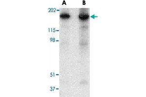 Western blot analysis of RTN4 in mouse brain tissue lysate with RTN4 polyclonal antibody  at (A) 0.