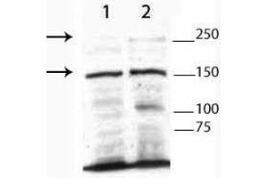 Western Blot of Rabbit Anti-TET3 Antibody. (TET3 Antikörper  (N-Term))