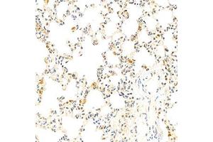 Immunohistochemistry (Paraffin-embedded Sections) (IHC (p)) image for anti-Eukaryotic Translation Initiation Factor 2, Subunit 2 Beta, 38kDa (EIF2S2) antibody (ABIN7073880)