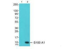 Western blot analysis of extracts from 293 cells (Lane 2), using S100 A1 antiobdy. (S1A1 Antikörper)
