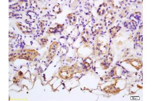 Formalin-fixed and paraffin embedded human kidney labeled with Rabbit Anti Tankyrase Polyclonal Antibody, Unconjugated (ABIN1385979) at 1:200 followed by conjugation to the secondary antibody and DAB staining
