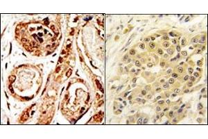 Image no. 1 for anti-SUMO/sentrin Specific Peptidase 3 (SENP3) (N-Term) antibody (ABIN356754) (SENP3 Antikörper  (N-Term))