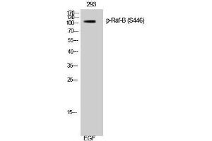 Western Blotting (WB) image for anti-B-Raf proto-oncogene, serine/threonine kinase (BRAF) (pSer446) antibody (ABIN3180451) (BRAF Antikörper  (pSer446))