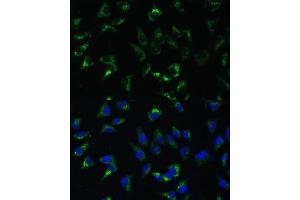 Immunofluorescence analysis of L-929 cells using USP46 Polyclonal Antibody (ABIN7271165) at dilution of 1:100 (40x lens). (USP46 Antikörper)