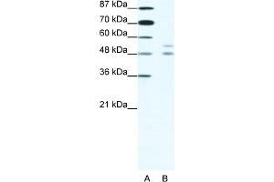 WB Suggested Anti-MITF Antibody Titration:  1. (MITF Antikörper  (N-Term))