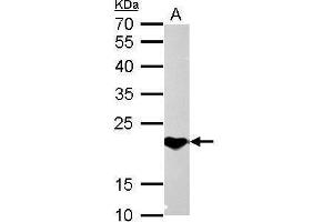 Western Blotting (WB) image for anti-Suppressor of Cytokine Signaling 1 (SOCS1) (C-Term) antibody (ABIN2854825)