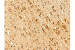 ABIN7094850 and ABIN7098901 at 1/100 staining Rat brain tissue by IHC-P. (CCT2 Antikörper  (C-Term))
