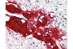 Anti-SLC22A16 antibody IHC staining of human adrenal. (SLC22A16 Antikörper  (AA 101-150))