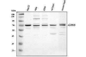 Western blot analysis of GRK5 using anti-GRK5 antibody (ABIN3042434). (GRK5 Antikörper  (C-Term))