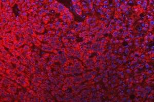IF analysis of Mitochondrial Dicarboxylate Carrier/SLC25A10 using anti-Mitochondrial Dicarboxylate Carrier/SLC25A10 antibody (ABIN7601497).