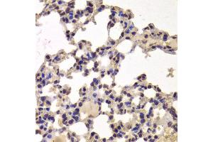 Immunohistochemistry of paraffin-embedded Mouse lung using HDAC7 antibody at dilution of 1:100 (x400 lens). (HDAC7 Antikörper)