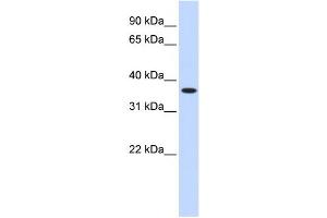 Western Blotting (WB) image for anti-Zinc Finger Protein 444 (ZNF444) antibody (ABIN2458190) (ZNF444 Antikörper)