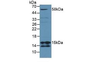 Detection of SDHD in Mouse Lung Tissue using Polyclonal Antibody to Succinate Dehydrogenase Complex Subunit D (SDHD) (SDHD Antikörper  (AA 1-159))