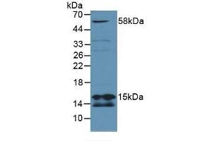 Detection of SDHD in Mouse Lung Tissue using Polyclonal Antibody to Succinate Dehydrogenase Complex Subunit D (SDHD)