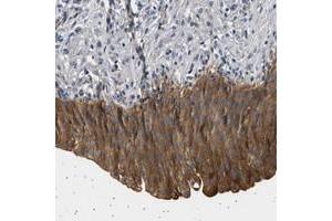 Immunohistochemical staining of human urinary bladder with PPAPDC2 polyclonal antibody  shows strong cytoplasmic positivity in urothelial cells at 1:50-1:200 dilution. (PPAPDC2 Antikörper)