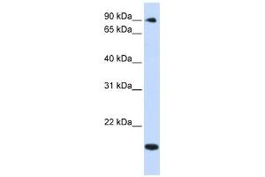 TSR1 antibody used at 1 ug/ml to detect target protein. (TSR1 Antikörper)