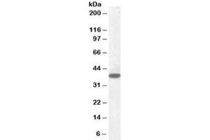 Western blot testing of human cerebellum lysate with Laforin antibody at 0. (EPM2A Antikörper)