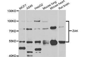 Western blot analysis of extracts of various cell lines, using ZAK antibody. (ZAK Antikörper)