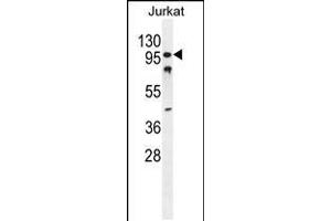 Western blot analysis in Jurkat cell line lysates (35ug/lane). (CWC22 Antikörper  (N-Term))