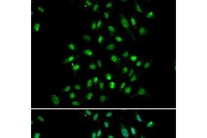Immunofluorescence analysis of A549 cells using CXXC1 Polyclonal Antibody (CXXC1 Antikörper)