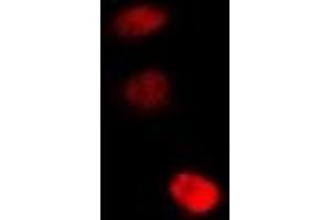 Immunofluorescent analysis of STAMBP staining in U2OS cells. (STAMBP Antikörper)