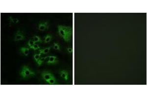 Immunofluorescence analysis of HeLa cells treated with EGF 200nM 5', using HER4 (Phospho-Tyr1284) Antibody. (ERBB4 Antikörper  (pTyr1284))