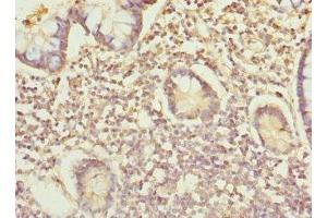 Immunohistochemistry of paraffin-embedded human small intestine tissue using ABIN7156305 at dilution of 1:100 (IP6K2 Antikörper  (AA 1-180))