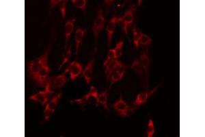 ABIN6275112 staining NIH-3T3 by IF/ICC. (EPH Receptor A10 Antikörper  (Internal Region))