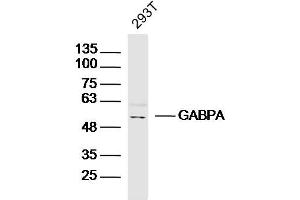 293T lysates probed with GABPA Polyclonal Antibody, Unconjugated  at 1:300 dilution and 4˚C overnight incubation. (GABPA Antikörper  (AA 51-150))