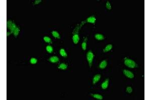 Immunofluorescent analysis of Hela cells using ABIN7163042 at dilution of 1:100 and Alexa Fluor 488-congugated AffiniPure Goat Anti-Rabbit IgG(H+L) (PHF1 Antikörper  (AA 151-360))