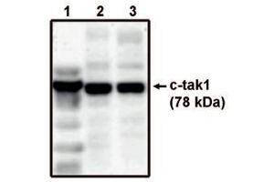 Image no. 1 for anti-MAP/microtubule Affinity-Regulating Kinase 3 (MARK3) antibody (ABIN793597) (MARK3 Antikörper)