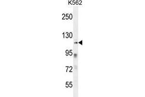 ZNF99 Antibody (N-term) western blot analysis in K562 cell line lysates (35 µg/lane). (ZNF99 Antikörper  (N-Term))