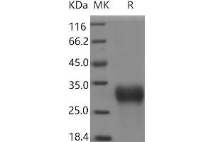 Western Blotting (WB) image for Insulin-Like Growth Factor Binding Protein 6 (IGFBP6) protein (His tag) (ABIN7321054) (IGFBP6 Protein (His tag))