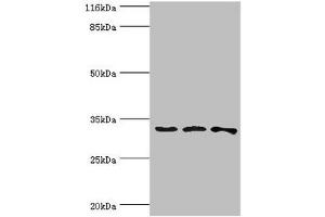 Western blot All lanes: STARD10 antibody at 2 μg/mL Lane 1: 293T whole cell lysate Lane 2: k562 whole cell lysate Lane 3: Mouse heart tissue Secondary Goat polyclonal to rabbit IgG at 1/10000 dilution Predicted band size: 33 kDa Observed band size: 33 kDa (STAR Antikörper  (AA 1-291))