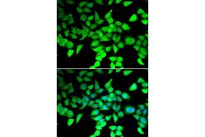 Immunofluorescence analysis of MCF-7 cells using HDAC7 antibody. (HDAC7 Antikörper  (AA 400-500))