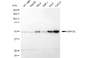 Western blotting analysis using SMPD2 antibody (ABIN7800421).