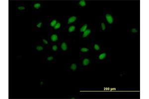 Immunofluorescence of purified MaxPab antibody to MXD3 on HeLa cell.