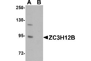 Western Blotting (WB) image for anti-Zinc Finger CCCH-Type Containing 12B (ZC3H12B) (N-Term) antibody (ABIN1031673) (ZC3H12B Antikörper  (N-Term))