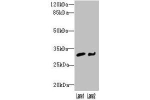 Western blot All lanes: NIT2 antibody at 3 μg/mL Lane 1: Mouse heart tissue Lane 2: A549 whole cell lysate Secondary Goat polyclonal to rabbit IgG at 1/10000 dilution Predicted band size: 31 kDa Observed band size: 31 kDa (NIT2 Antikörper  (AA 1-276))
