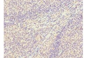 Immunohistochemistry of paraffin-embedded human tonsil tissue using ABIN7170368 at dilution of 1:100 (SNX18 Antikörper  (AA 449-628))