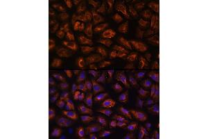 Immunofluorescence analysis of U-2 OS cells using VEGFR3/FLT4 Rabbit pAb (ABIN6130780, ABIN6140699, ABIN6140702 and ABIN6221242) at dilution of 1:100 (40x lens). (FLT4 Antikörper  (AA 1174-1363))