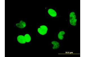 Immunofluorescence of monoclonal antibody to CTBP1 on HeLa cell.