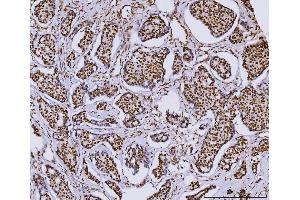 IHC analysis of RCC1 using anti-RCC1 antibody (ABIN7600022).