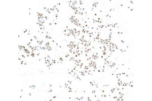 Immunocytochemistry (ICC) image for anti-N-Myc Proto-Oncogene Protein (MYCN) (AA 100-150) antibody (ABIN7795786)