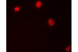Immunofluorescent analysis of Importin alpha 1 staining in HepG2 cells. (KPNA2 Antikörper)