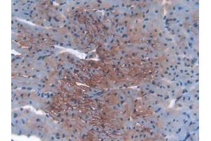 DAB staining on IHC-P; Samples: Mouse Heart Tissue (IGF2R Antikörper  (AA 1148-1365))